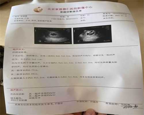 咨询代孕哪家好,人工授精后能吃生葱吗-人工授精后能吃生葱吗有影响吗