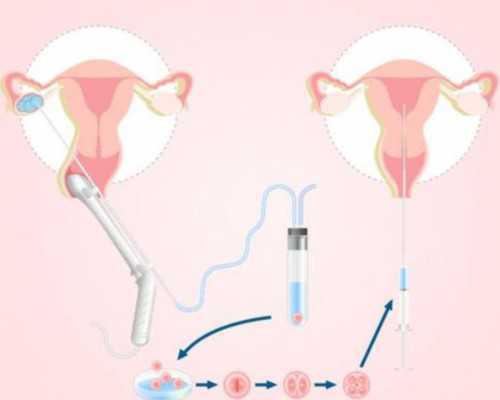 成都代孕试管生子的医院,成都最好的生殖医院怎么选_成都比较好的生殖医院