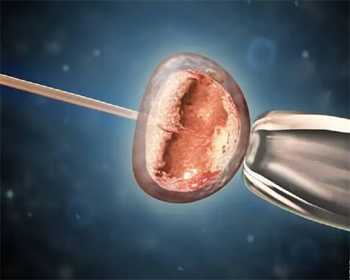 口碑最好的代孕公司_国内供卵条件有哪些,孕妇建档需要什么资料？