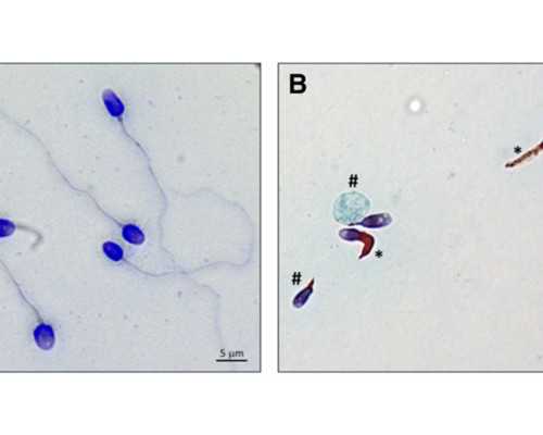 成都助孕男孩子医院，成都助孕想要孩子,成都做试管比较好的医院排名一览表