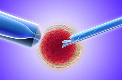 试管婴儿为什么做染色体检查？专家解读试管婴儿胚胎染色体检查