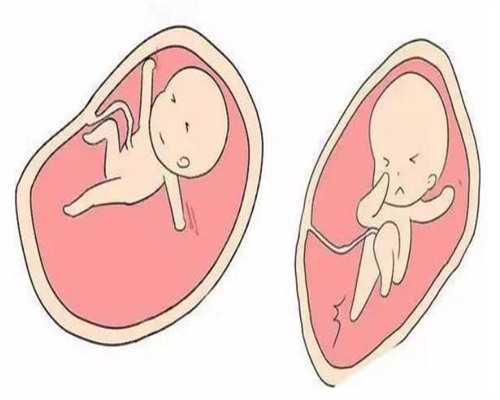 单身做试管了是什么感觉？这7个症状告诉你