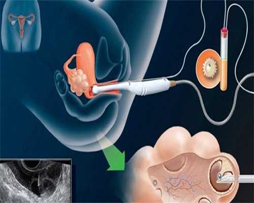 哪一家做代孕好,胎儿性别这一刻就被决定，所谓的“男女互翻”，很多人搞错